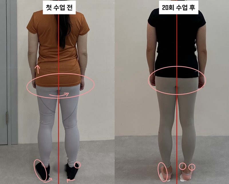 필라테스 첫 수업 전과 20회 수업 후 뒷모습 비교 — 골반·발 정렬 변화